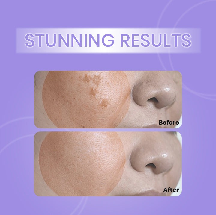 Dark Spot Repair Lotion without side effects 